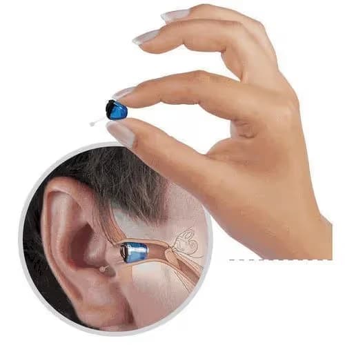 Completely-in-Canal (CIC) hearing aid