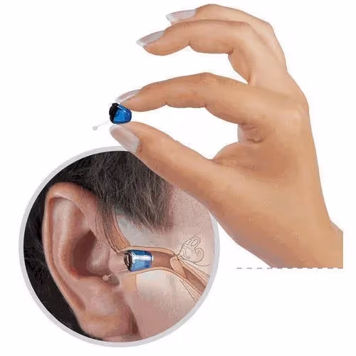 Completely-in-Canal (CIC) hearing aid
